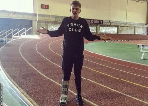 Andy Butchart with foot in a protective boot